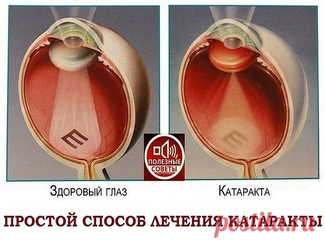 (73) Одноклассники