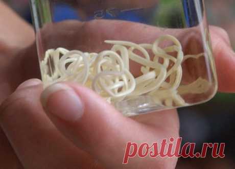 Гельминтоз и его симптомы На сегодняшний день многие люди из-за постоянной занятости не обращают внимание на свое здоровье, не подозревая о наличии заболеваний. Часто встречается...