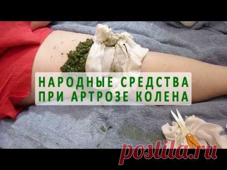 Народные средства для лечения артроза коленного сустава