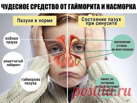 (35) Одноклассники