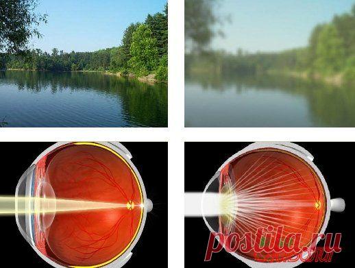 Народные средства лечения катаракты