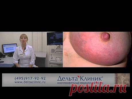Рак молочной железы. Диагностика. Профилактика. - YouTube