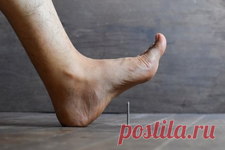 Россиянам назвали первые симптомы смертельно опасной болезни. Дерматовенеролог Роман Иванов рассказал, что столбняк — опасное инфекционное заболевание, которое может привести к инвалидности и смерти. Заразиться им можно, поранившись ржавыми или грязными предметами. Первыми симптомами столбняка врач назвал спазмы в мышцах и судороги.