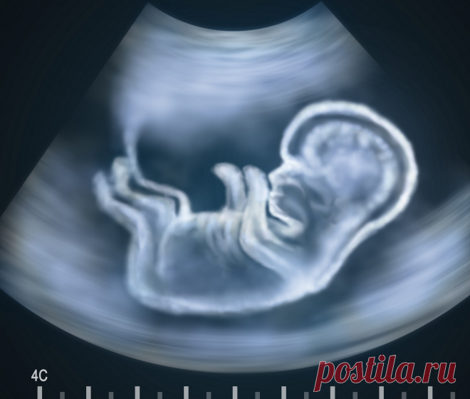 Пренатальная диагностика заячьей губы и волчьей пасти