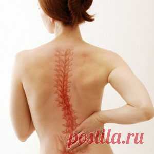 Сколиоз: профилактика, лечение / Будьте здоровы