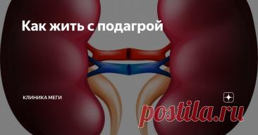 Как жить с подагрой Статья автора «Клиника Меги» в Дзене ✍: В переводе с греческого подагра – «охота на ногу».