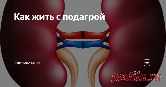Как жить с подагрой Статья автора «Клиника Меги» в Дзене ✍: В переводе с греческого подагра – «охота на ногу».