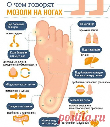 О чем говорят мозоли на ногах: диагностика заболеваний по мозолям 
Известно, что каждая зона на подошве стопы является проекцией определенного внутреннего органа. Поэтому если внимательно изучить свои стопы, то легко провести диагностику по мозолям и после этого про…