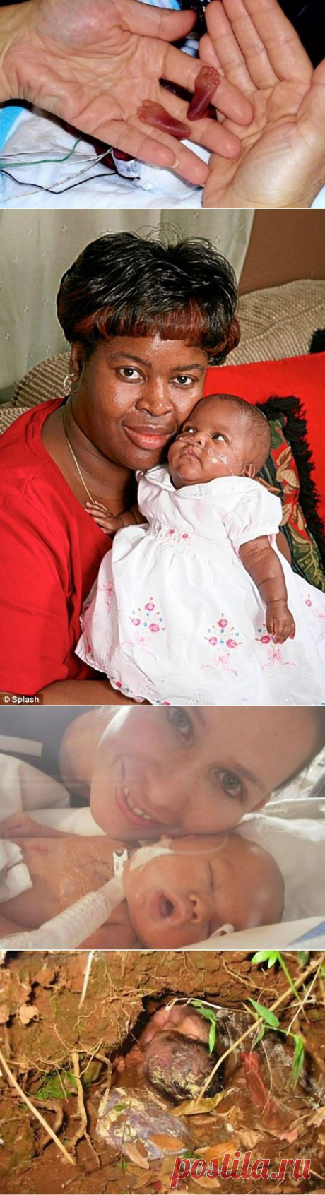 7 невероятных историй выживания младенцев • НОВОСТИ В ФОТОГРАФИЯХ