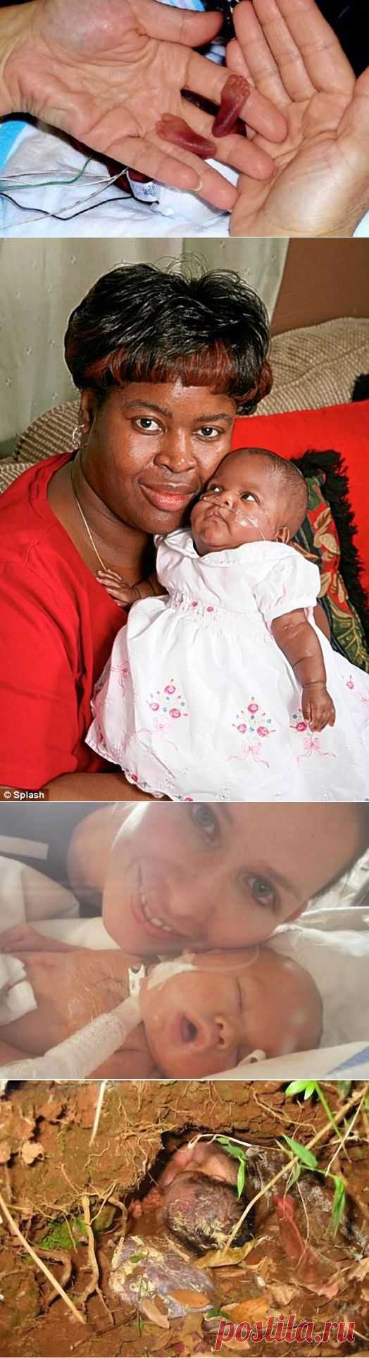 7 невероятных историй выживания младенцев • НОВОСТИ В ФОТОГРАФИЯХ