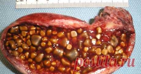 (1) Facebook