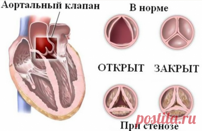Как болит сердце: основные причины и симптомы боли в сердце