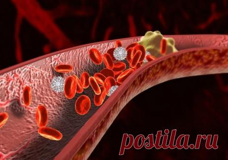 Коктейль, который избавит от тромбов | Polza-vred.su