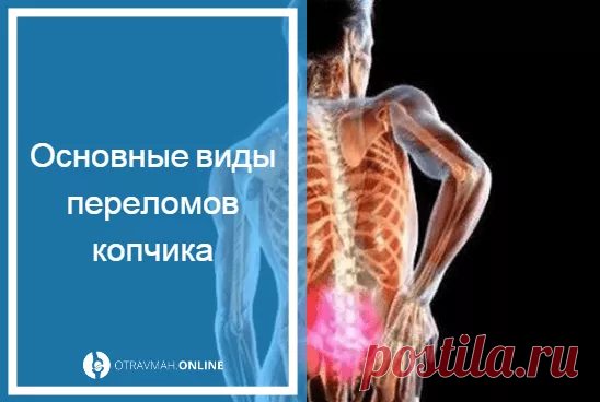 Сколько заживает перелом копчика 🔎 - как долго срастается
