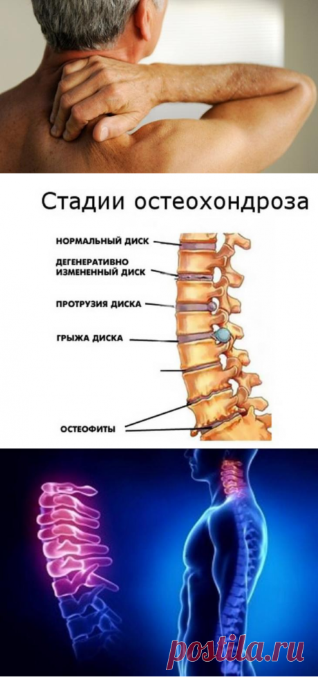 Остеохондроз — расплата за непонимание собственного организма