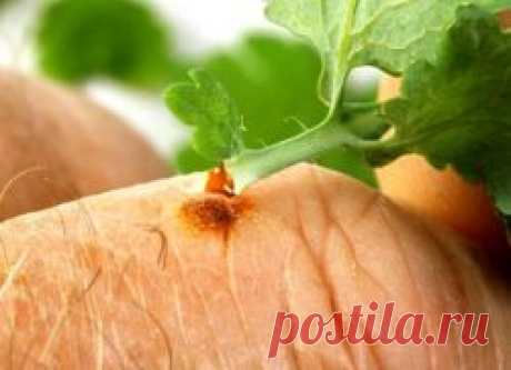 Сок чистотела - применение.