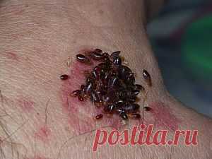 Как выглядят укусы клопов »