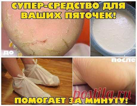 Пяточки