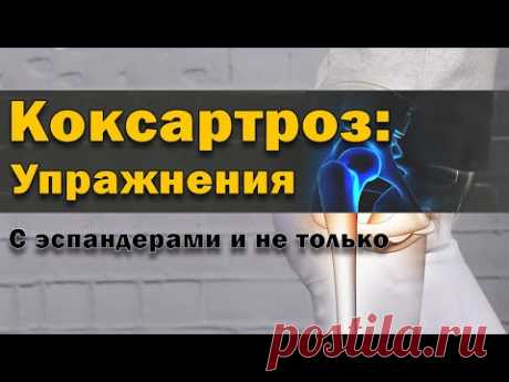 Упражнения при артрозе тазобедренного сустава - коксартрозе 3-4 степени