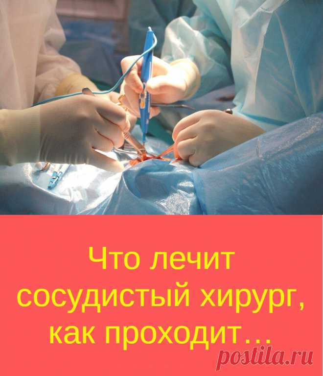 Что лечит сосудистый хирург, как проходит…