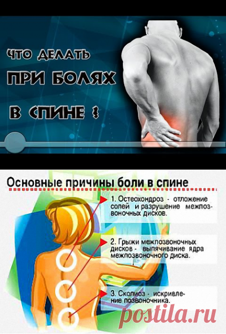 УПРАЖНЕНИЯ ПРИ БОЛЯХ В СПИНЕ.