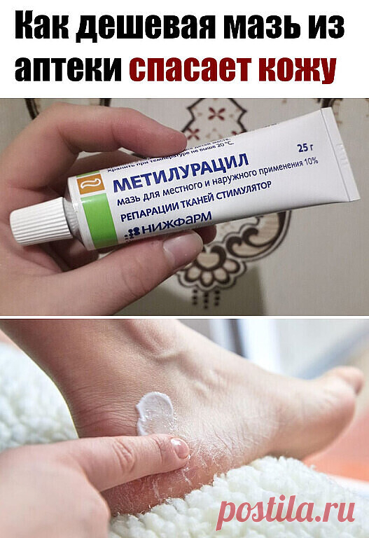 Моя соседка по даче, тетя Вера, медработник со стажем. Это сейчас она обмазывается дорогими кремами с ног до головы, чтобы сохранить остатки былой красоты. А еще лет 15 назад ее косметичка состояла исключительно из дешевых аптечных средств. Впрочем, от некоторых из них она не отказывается и в свои 57. Возьмем, к примеру, мазь «Метилурацил» для рук. Как работает мазь...Читать дальше »