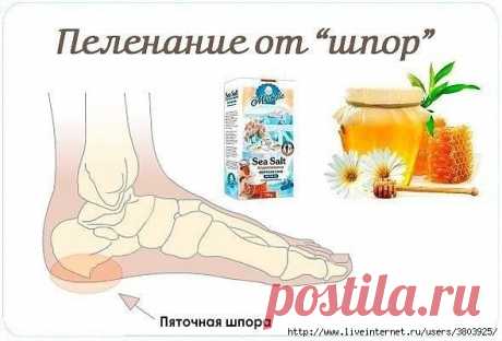 Лечебное пеленание от шпор