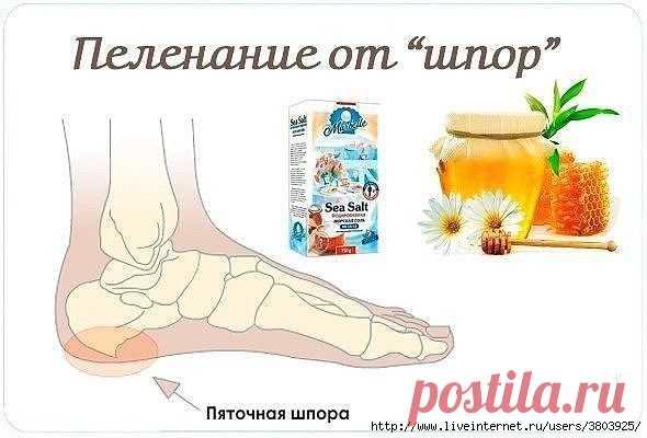 Лечебное пеленание от шпор