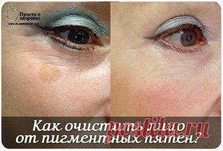 Как очистить лицо от пигментных пятен?