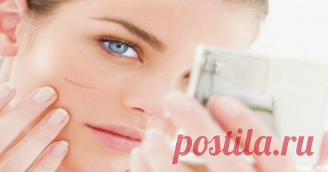 Есть шрам? Прочти это и сделай его незаметным!