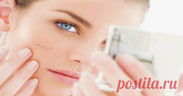 Есть шрам? Прочти это и сделай его незаметным!