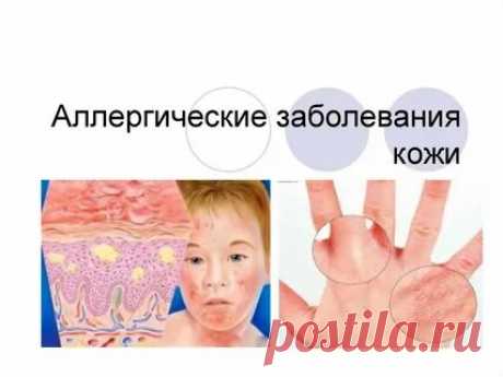 Яндекс Картинки: поиск похожих изображений