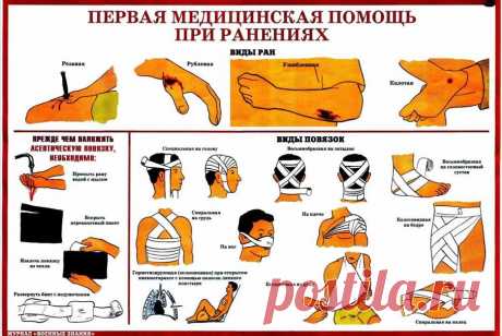 Первая помощь при кровотечении | Выживи сам