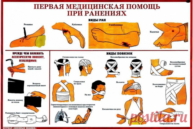 Первая помощь при кровотечении | Выживи сам