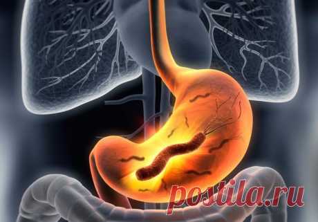 Средства от изжоги: подручные и домашние способы лечения