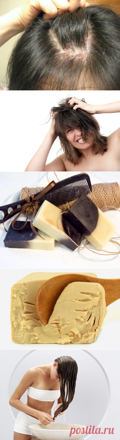 Прыщи на голове в волосах у женщин причины лечение