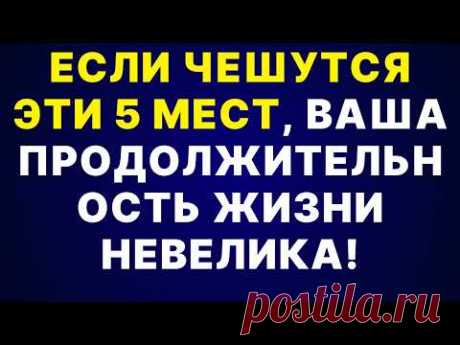 5 МЕСТ, КОТОРЫЕ ЧЕШУТСЯ У ПОЖИЛЫХ ЛЮДЕЙ И МОГУТ УКАЗЫВАТЬ НА КОРОТКУЮ ЖИЗНЬ