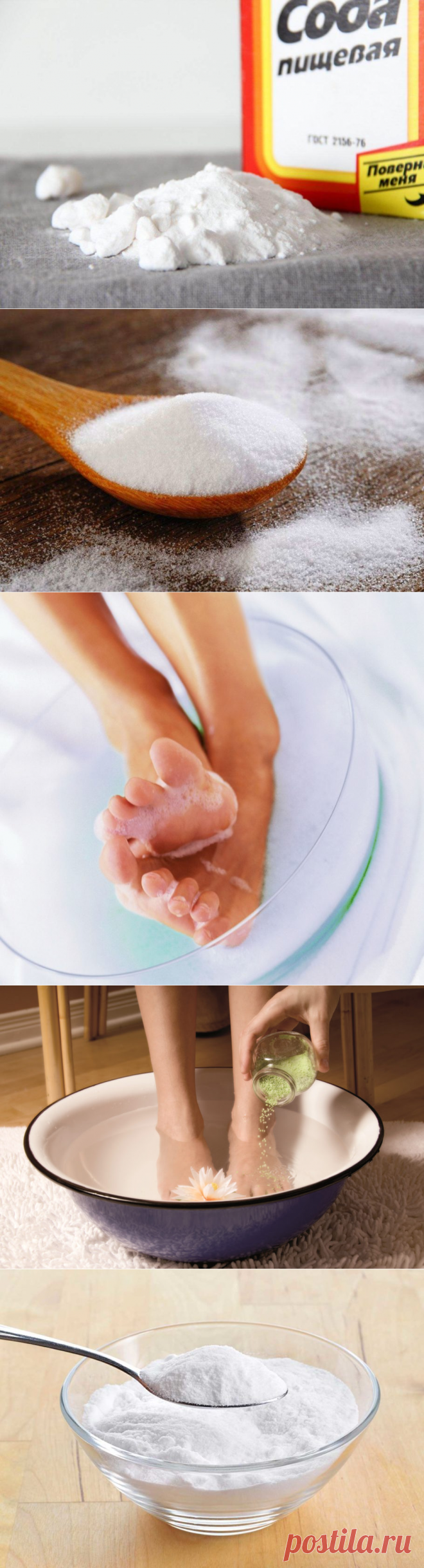 Лечение варикоза содой — способы ⋆ Инструкция и Отзывы ⋆