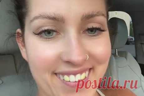 Женщина показала неожиданно пожелтевшие после визита к стоматологу зубы. Блогерша Тиффани (фамилия неизвестна) нанесла визит стоматологу и показала неожиданно пожелтевшие зубы. На размещенных кадрах предстала с ярко-желтыми передними зубами. По словам юзерши, доктор установил ей временные коронки, однако не предупредил, что после манипуляций нельзя употреблять еду с красящими веществами.
