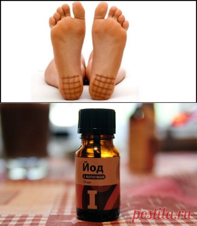 Вот что получится, если нанести немного йода на пятки