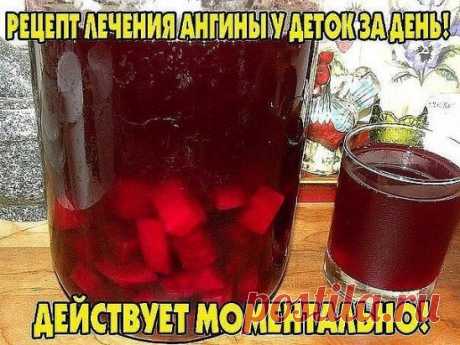 Рецепт лечения ангины за 1 день!