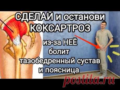 Сделай и останови КОКСАРТРОЗ / из-за этой мышцы болит тазобедренный сустав и поясница + перекос таза