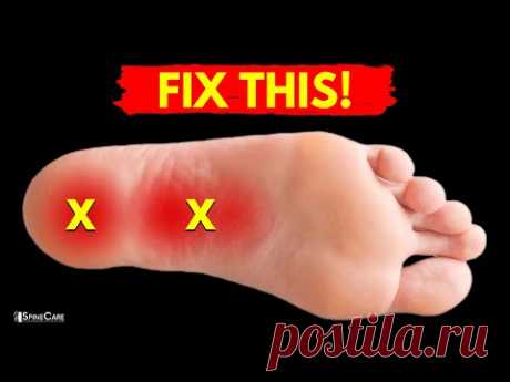 How to Relieve PLANTAR FASCIITIS Pain in Seconds