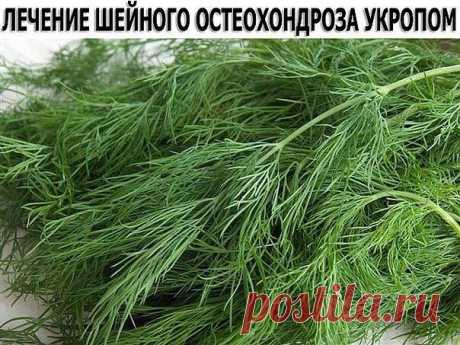 ЛЕЧЕНИЕ ШЕЙНОГО ОСТЕОХОНДРОЗА УКРОПОМ.
Настоять 200 г семян укропа на 250 мл водки 2 недели. Принимать по 1 ст. л. З раза в день перед едой. Мы настаивали 400 г семян укропа на 500 мл спирта, разведенного пополам. Готовили такую порцию 3 раза. И муж выздоровел. Болезнь не возвращалась на протяжении дальнейшей его жизни. Прожил он до 86 лет, а болел в возрасте 59-60 лет. Работал до 74 лет. В любую погоду ходил - грудь нараспашку, и шарф не носил. Вот два случая выздоровлени...