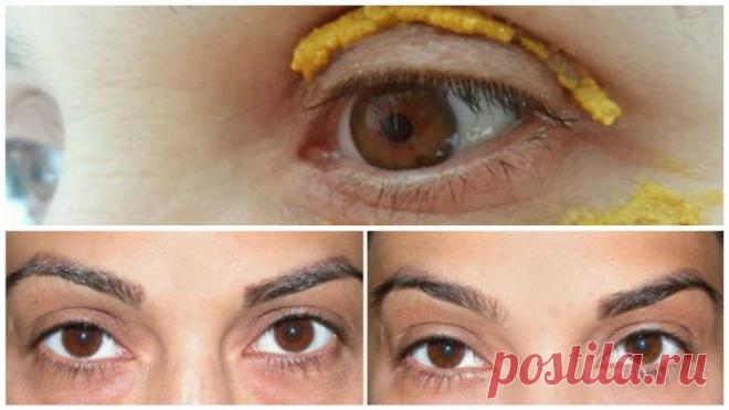 Она начала наносить куркуму вокруг глаз. Спустя 10 минут, результаты были невероятны!