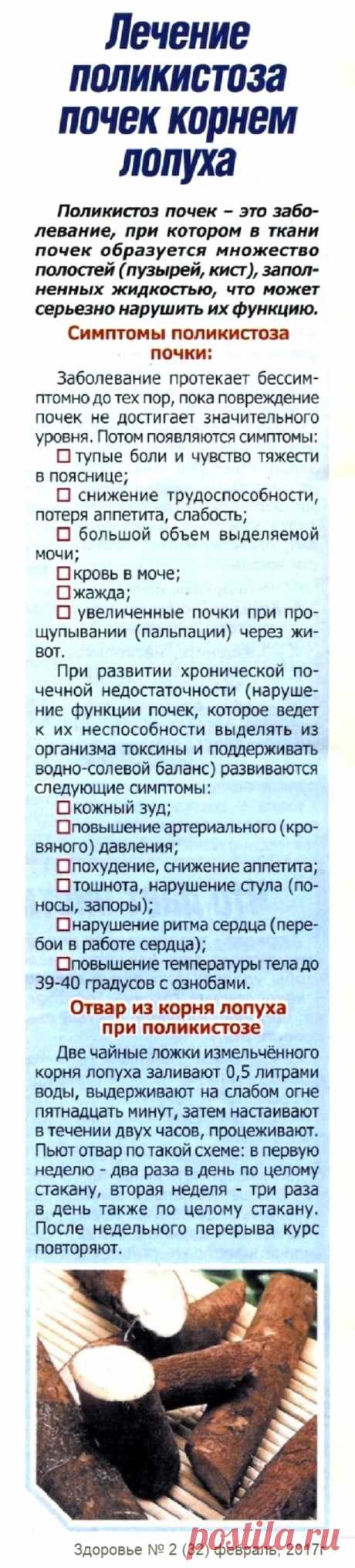Лечение поликистоза почек корнем лопуха