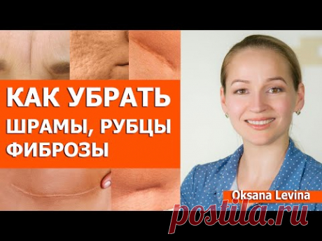 Как убрать рубцы и шрамы на коже. Шрамы после прыщей, рубцы на теле и другие фиброзы