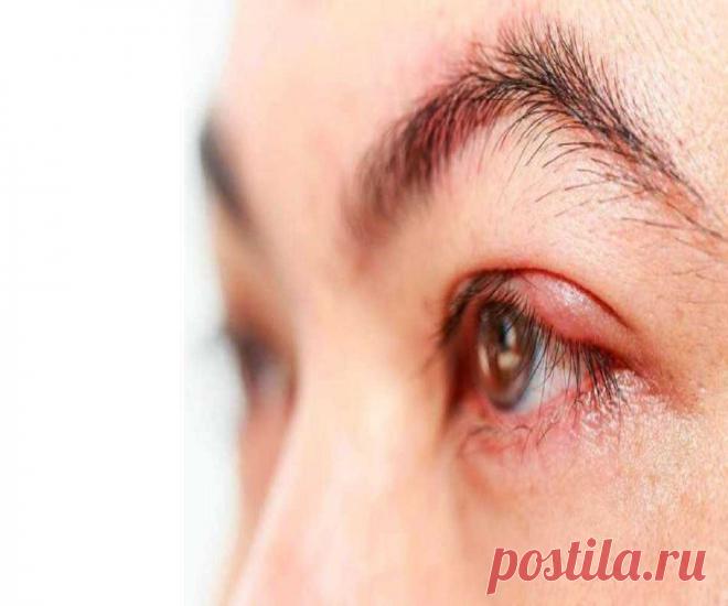 Есть ли заговор от ячменя на глазу, который можно читать самой себе? Заговоры от ячменя на глазу 100% Заговоры и заклинания