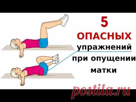 Как НЕЛЬЗЯ❗️делать упражнения при опущении матки, влагалища, недержании мочи, миоме, полипах, кистах