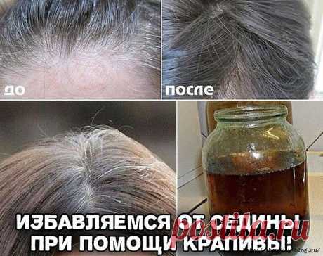 ИЗБАВЛЯЕМСЯ ОТ СЕДИНЫ ПРИ ПОМОЩИ КРАПИВЫ!